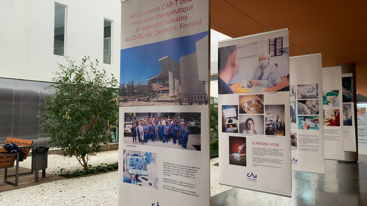Au CHU de Clermont-Ferrand, une exposition retrace le traitement contre certains cancers hématologiques Au CHU de Clermont-Ferrand, une exposition retrace le traitement contre certains cancers hématologiques